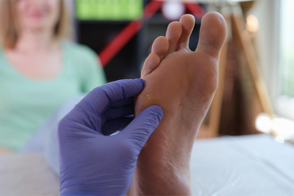Cuidados Essenciais com os Pés para Pacientes Diabéticos
